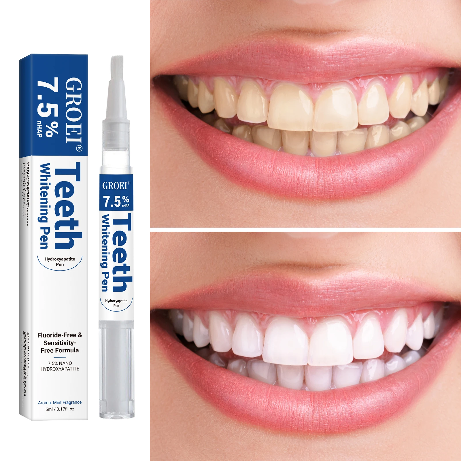هيدروكسياباتيت تبييض الأسنان ا - مراجعة Teeth Whitening Ai وسعره