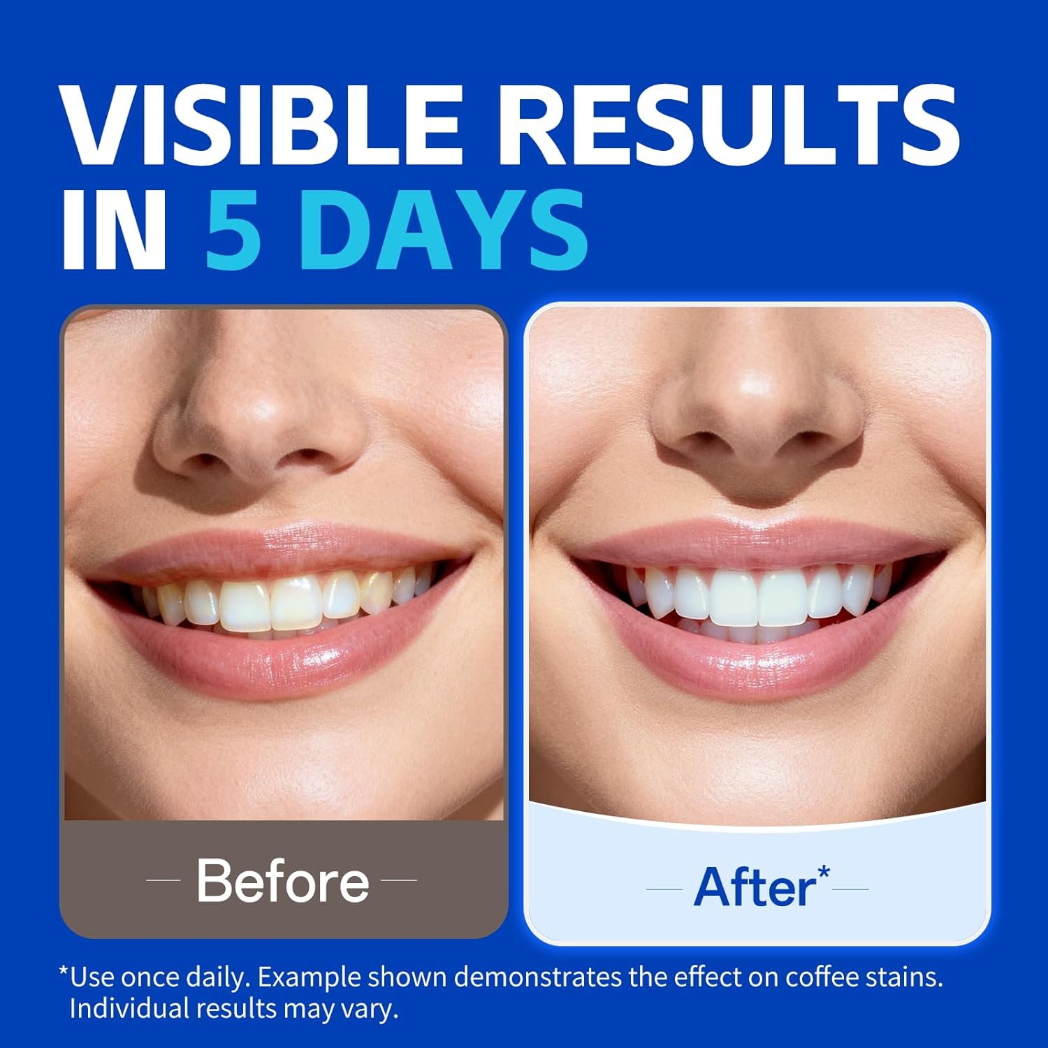7 أزواج من شرائط تبييض الأسنان - مراجعة Teeth Whitening Strips وسعره