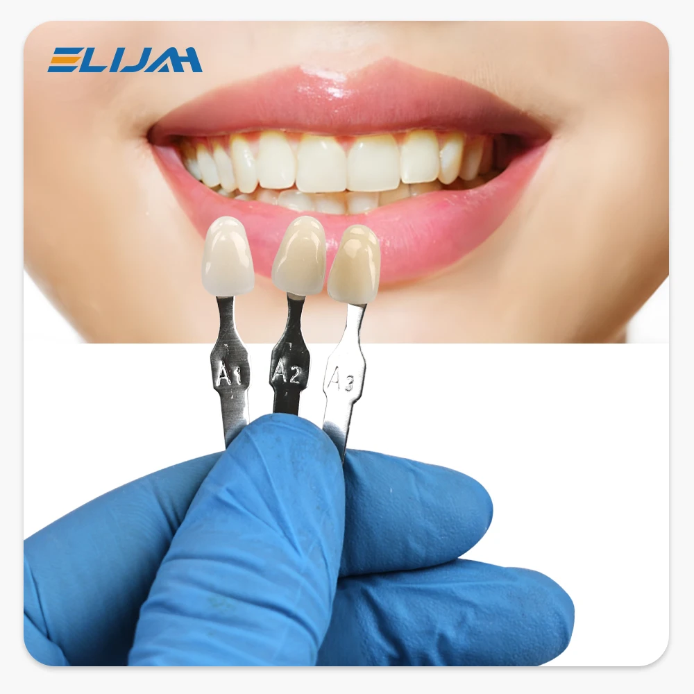 دليل تبييض الأسنان الرئيسي من  - مراجعة Teeth Whitening/Bleaching وسعره