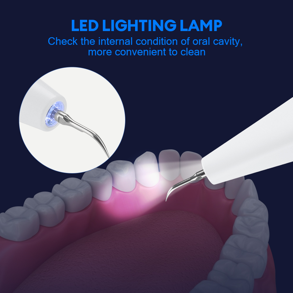 بالموجات فوق الصوتية مزيل حساب - مراجعة Teeth Whitening Strips وسعره