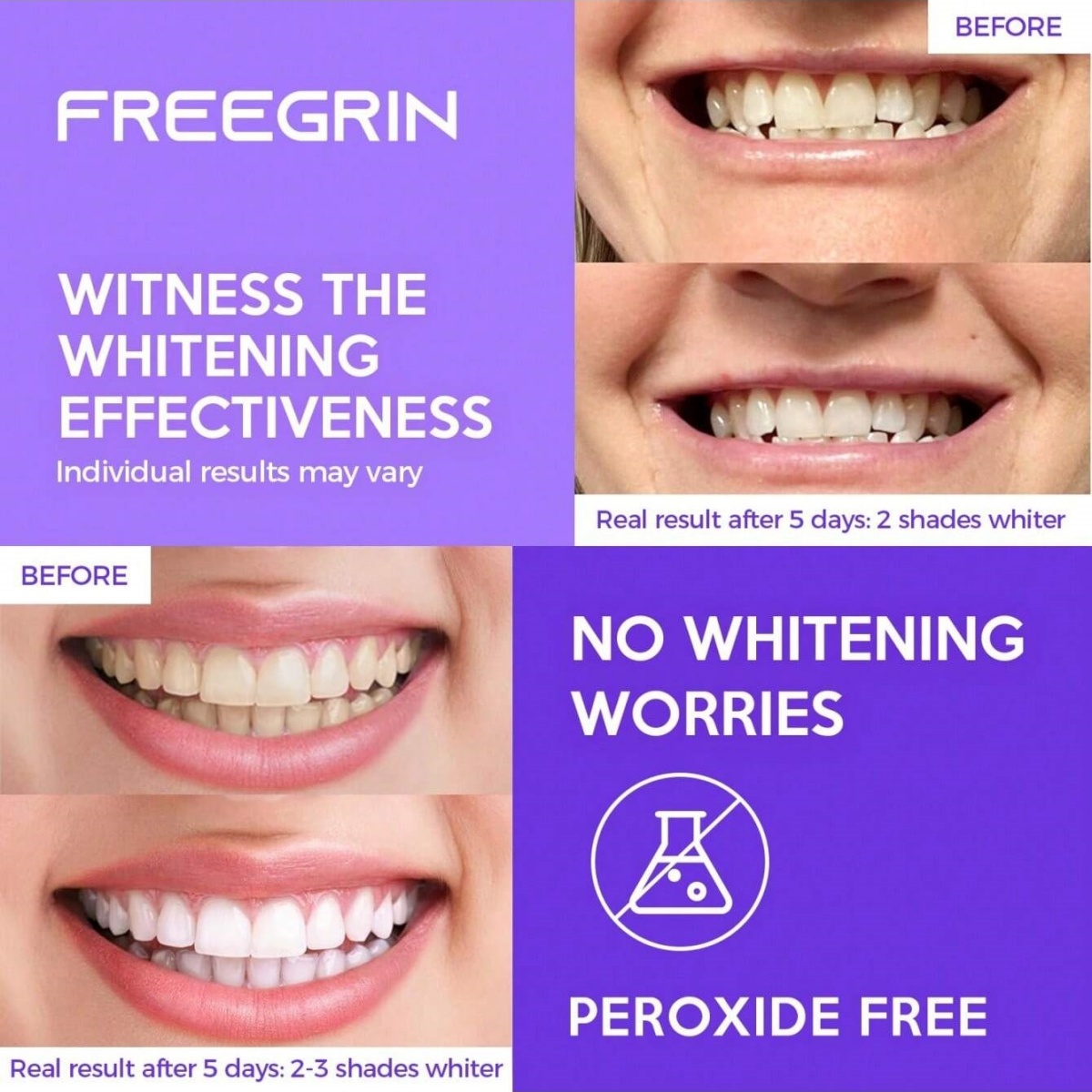 ديلوكس تبييض الأسنان ملصقات 7/ - مراجعة Teeth Whitening Ai وسعره